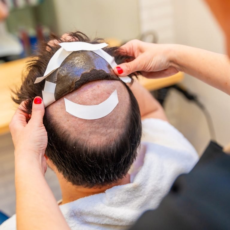 Top view close-up of a hairstylist attaching a wig to a man using adhesive stripes